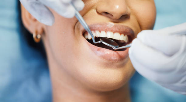 Best Emergency Denture Repair in West Swanzey, NH